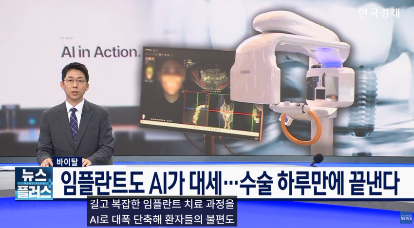임플란트도 AI가 대세…수술 하루 만에 끝낸다 (2)