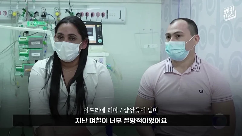 33시간 수술 끝에 얼굴 본 쌍둥이 (12)