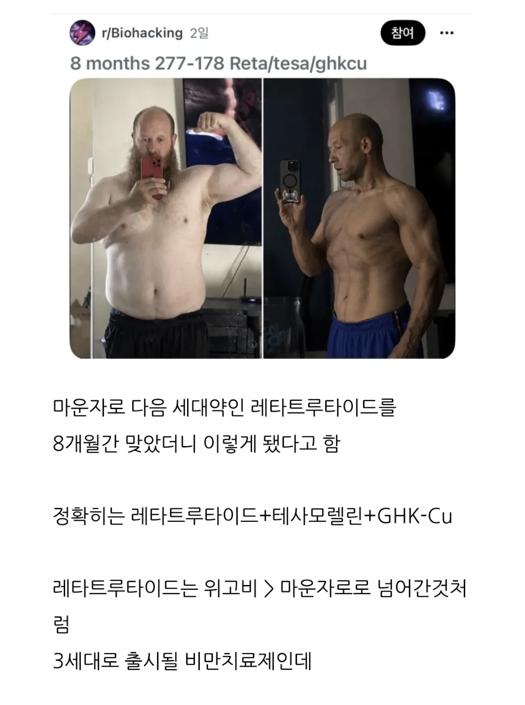 차세대 비만약(마운자로 다음) 근황 (2)