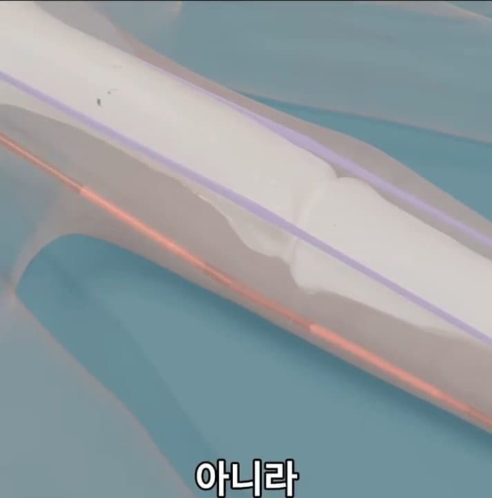싱글벙글 손가락이 잘렸을 때 대처법 (37)