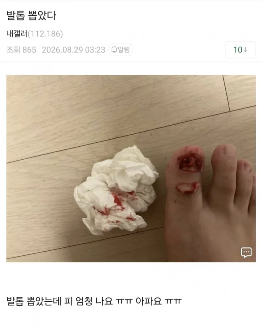 (혐) 인간의 정신력을 볼 수 있는 갤러리 (3)