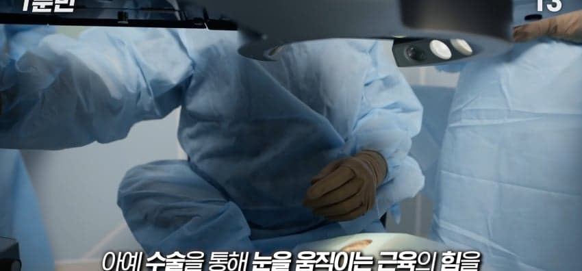 사시는 과연 어떻게 보일까...? (35)