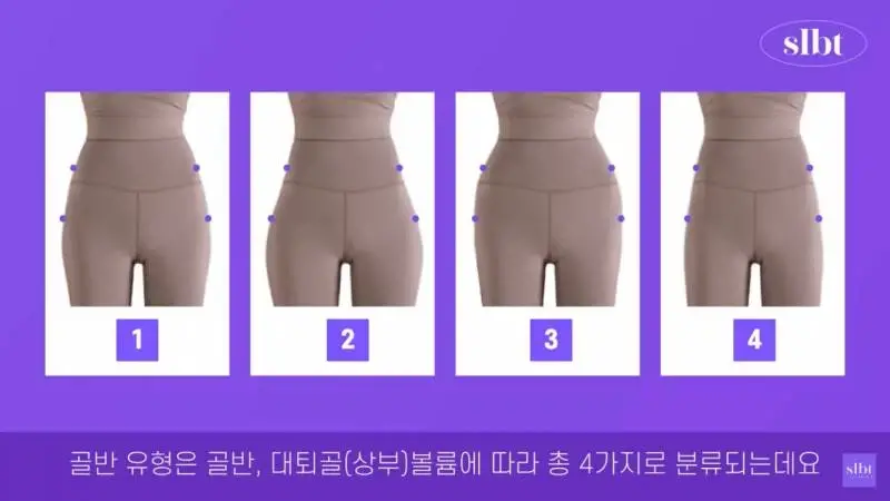 여자 골반의 종류 (2)