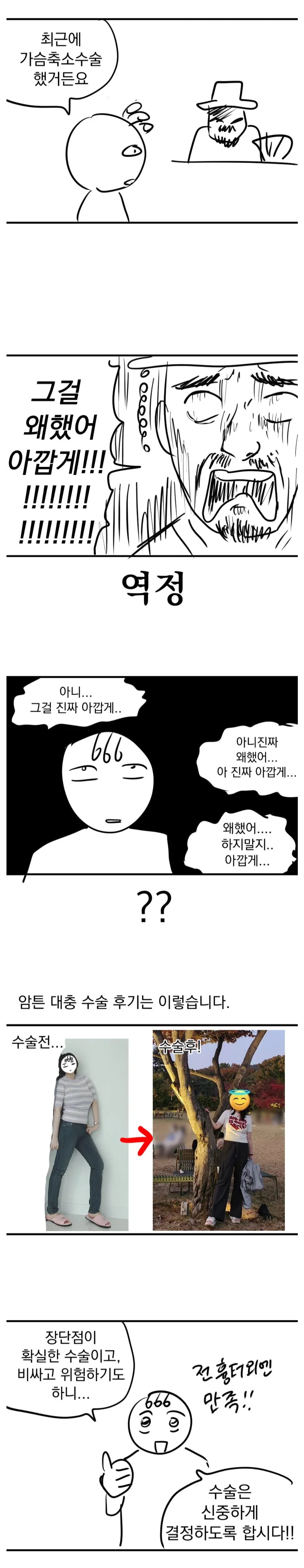 H컵 가슴 축소 후기 (2)