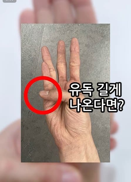 긴급) 지금 이동작 안되면 바로 병원에 가야 합니다! (29)