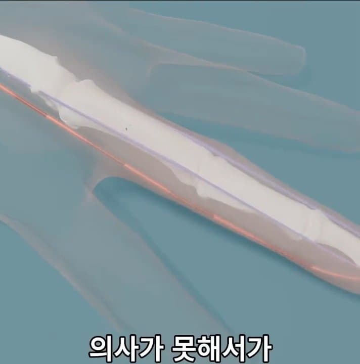 싱글벙글 손가락이 잘렸을 때 대처법 (36)