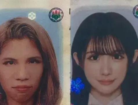 충격적인 2억원어치 성형결과.. (5)