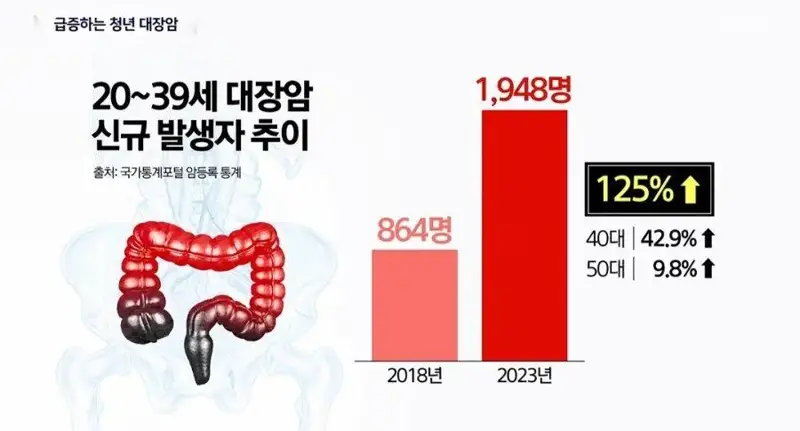 “20-30대 대장암 환자가 늘어나는 이유” (4)