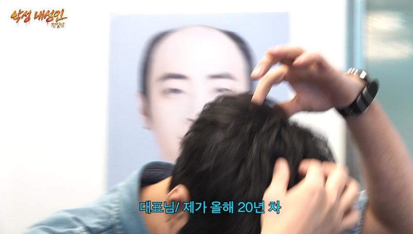 싱글벙글 21살부터 탈모였다는 올해 41살인 남자 사장 (2)