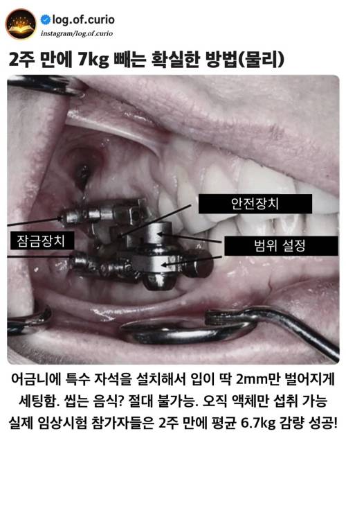 물리적으로 2주 만에 7kg 빼는 확실한 방법