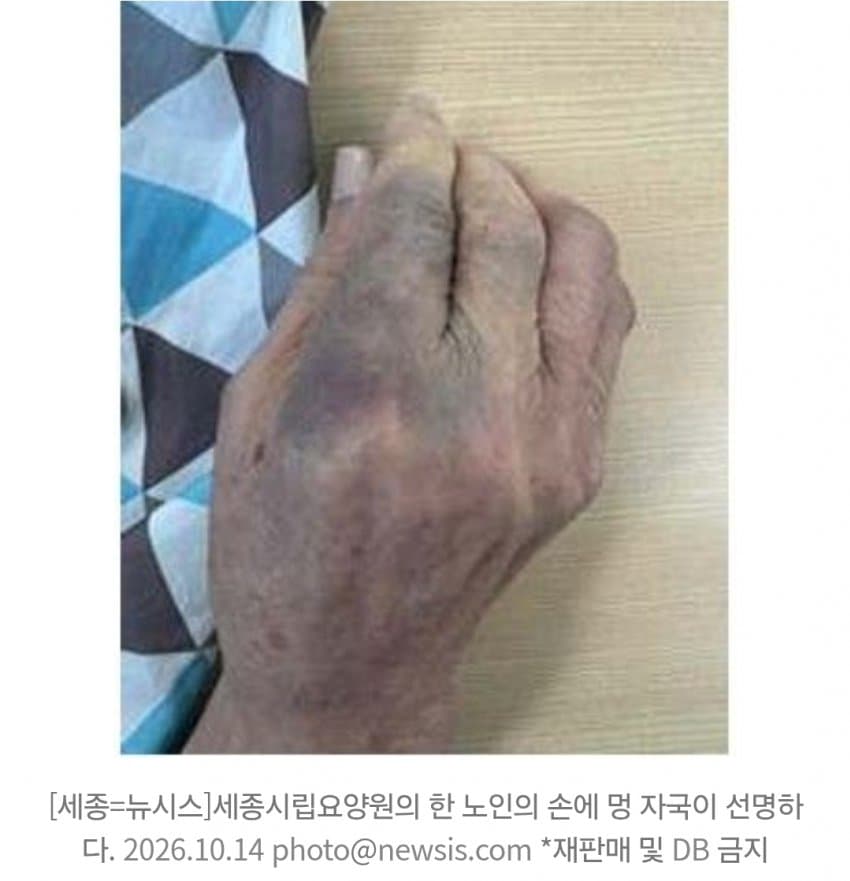 얼굴에 샤워기 쏘며 학대…세종시립요양원 늑장 대응 '논란' (5)