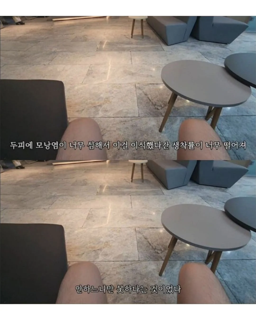 터키로 모발이식 받으러간 남자의 최후 (4)