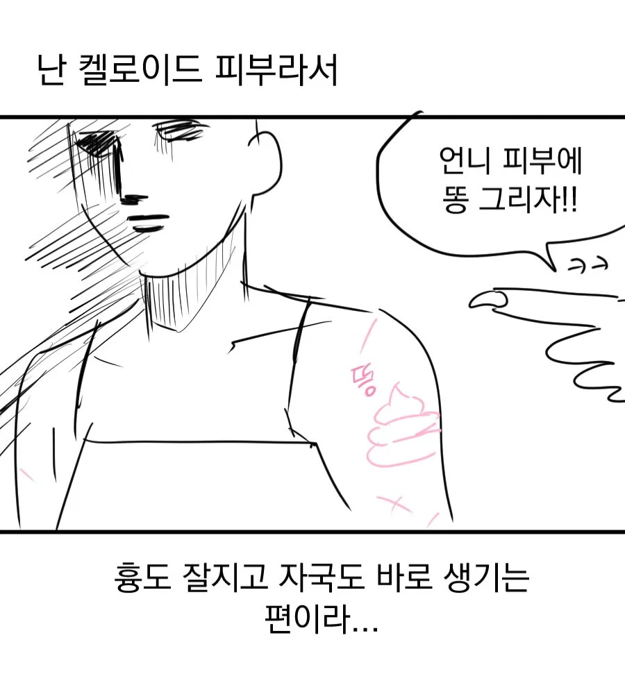 어느 웹툰 작가의 가슴 축소 수술 후기 만화 (26)