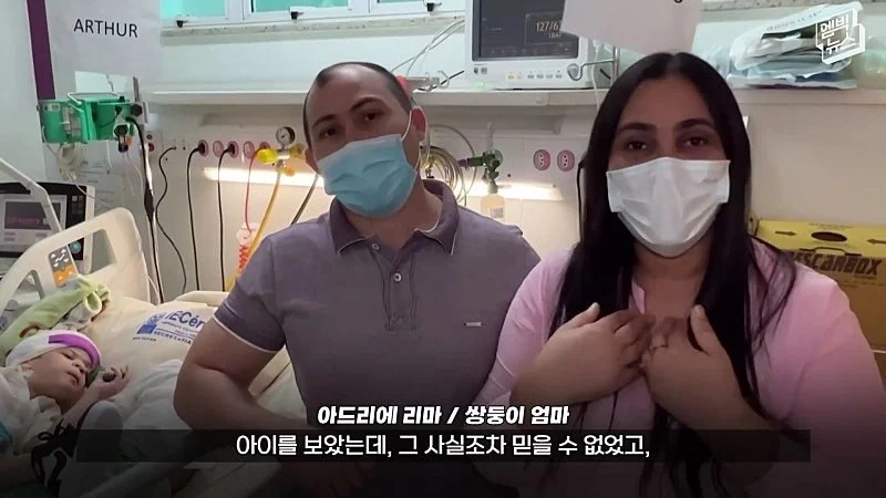 33시간 수술 끝에 얼굴 본 쌍둥이 (43)