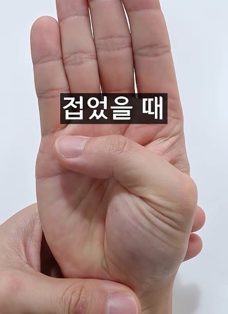 긴급) 지금 이동작 안되면 바로 병원에 가야 합니다! (27)