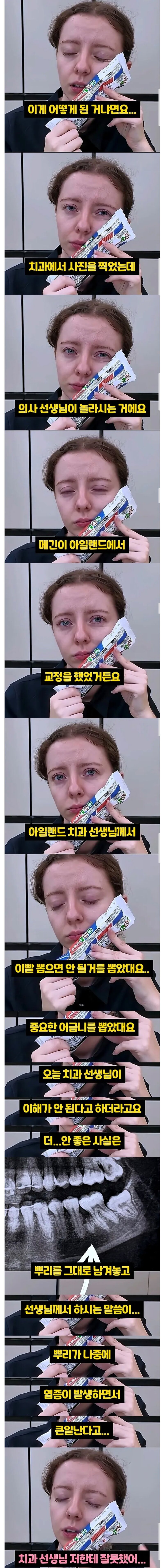 한국에 와서 밝혀진 아일랜드 유부녀의 12년 치통의 원인.. (2)
