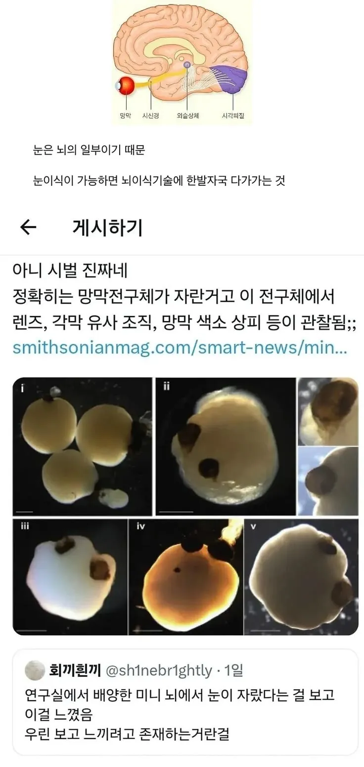 간도 심장도 다 이식이 되는데 눈은 안되는 이유