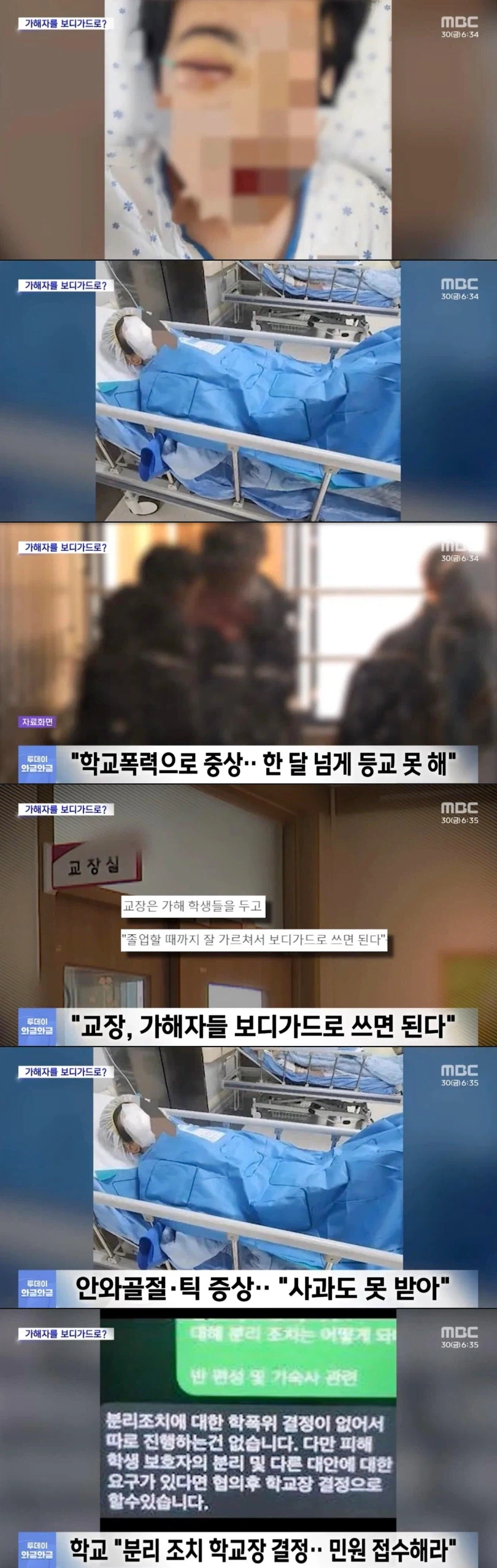 학교폭력으로 중상.. 한 달 넘게 등교 못 해