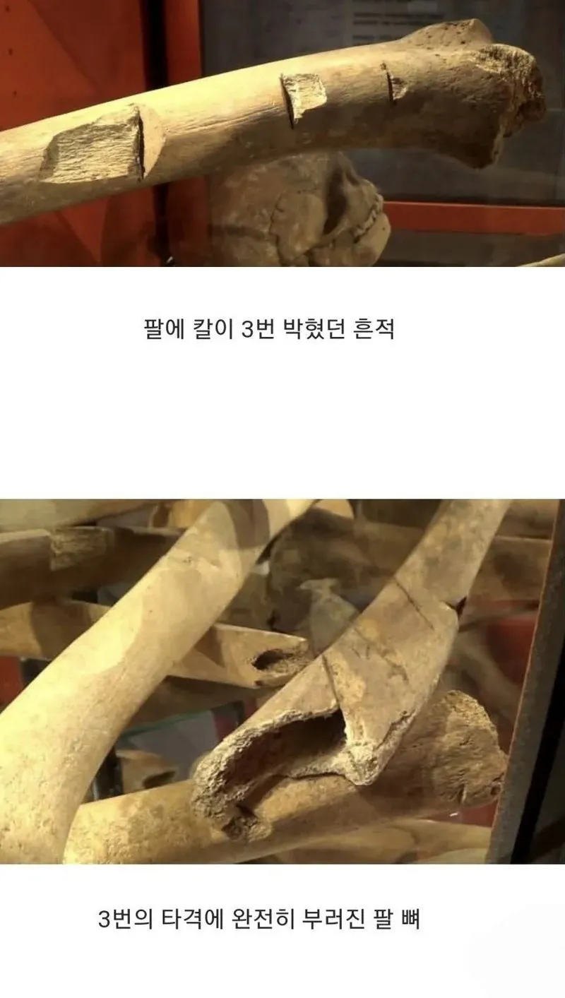 15세기 영국, 병사들의 유골