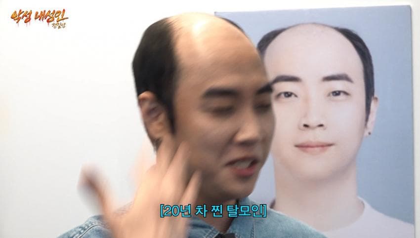 싱글벙글 21살부터 탈모였다는 올해 41살인 남자 사장 (15)