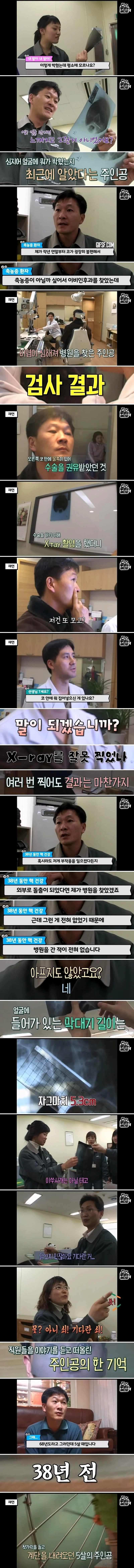 축농증 수술하러 갔다가 발견한 물건의 정체 (2)