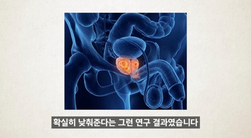 한달에 21번 사정하라 (36)
