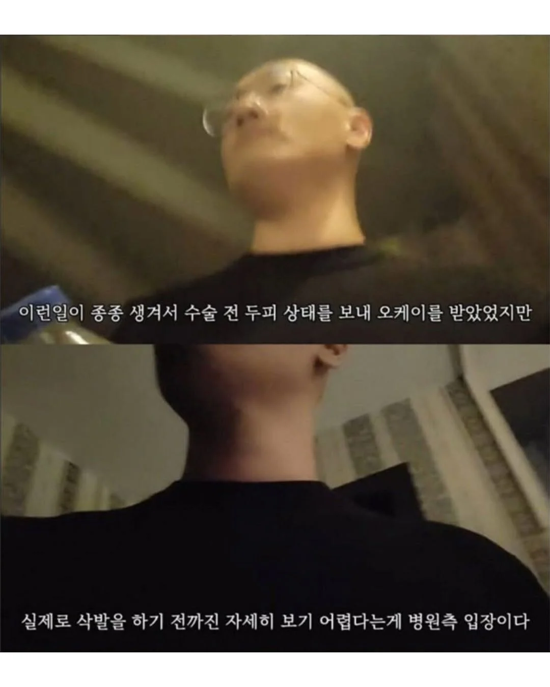 터키로 모발이식 받으러간 남자의 최후 (5)