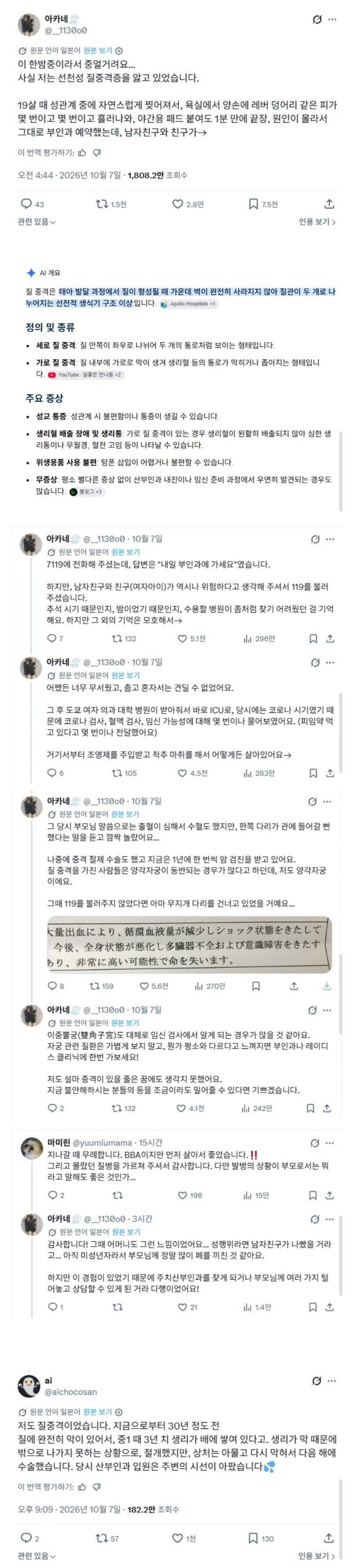 19살때 섹스하다가 실제로 죽을 뻔했다는 츠자.. (2)