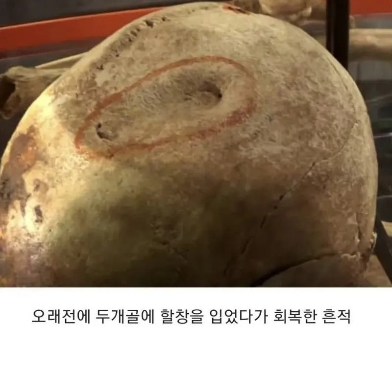 15세기 영국, 병사들의 유골