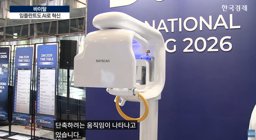 임플란트도 AI가 대세…수술 하루 만에 끝낸다 (5)