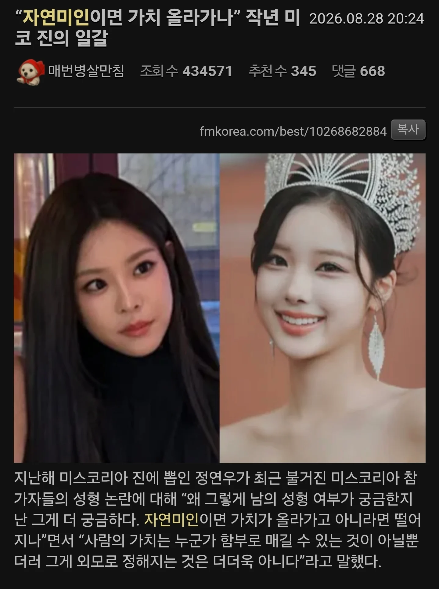 "성형 안했으면 가치 올라가나" 일침... 남초 반응