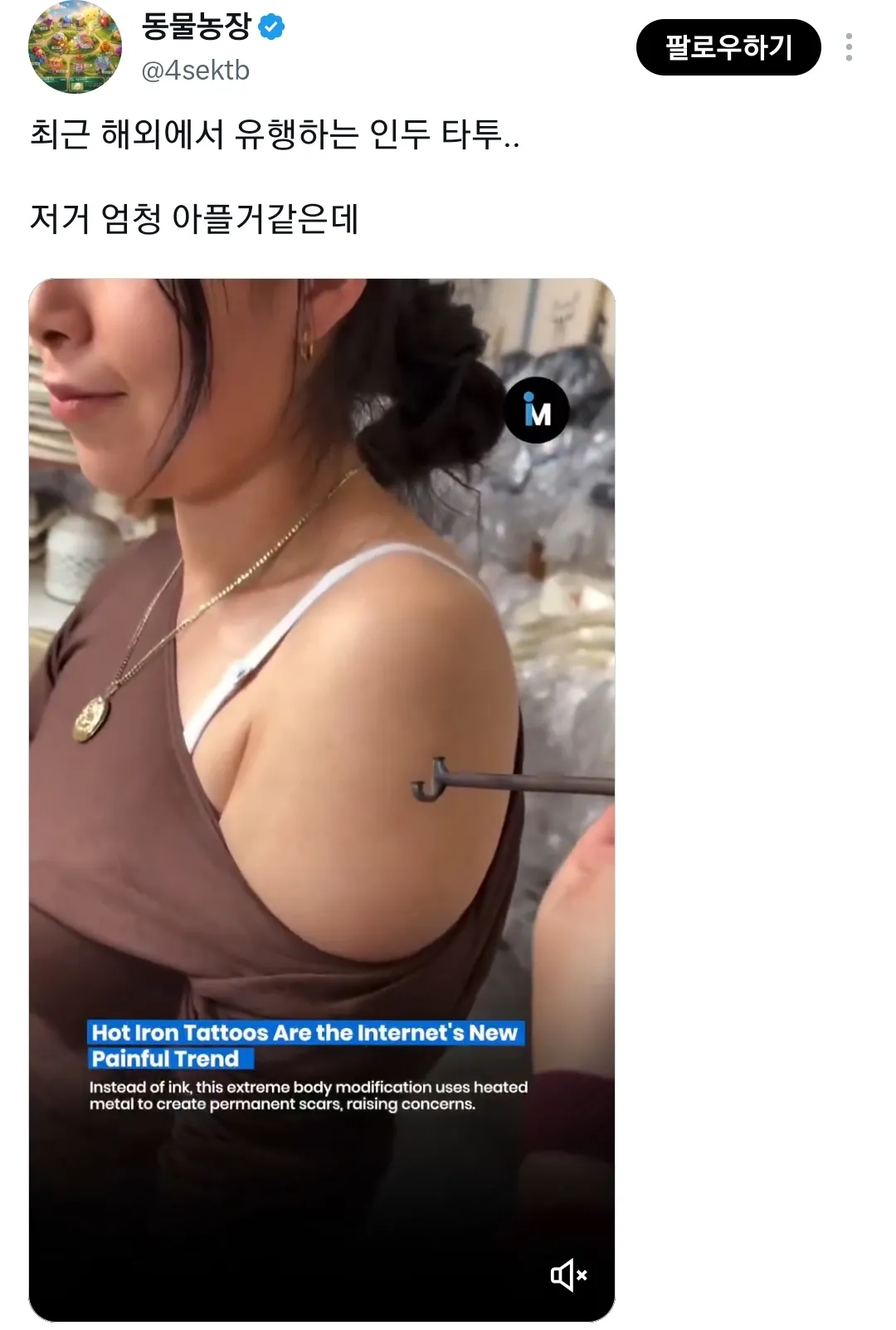 최근 해외에서 일부 사람들에게 유행중이라는 인두 타투