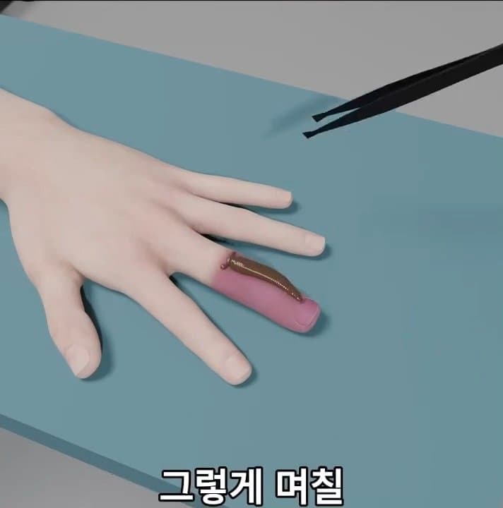 싱글벙글 손가락이 잘렸을 때 대처법 (46)