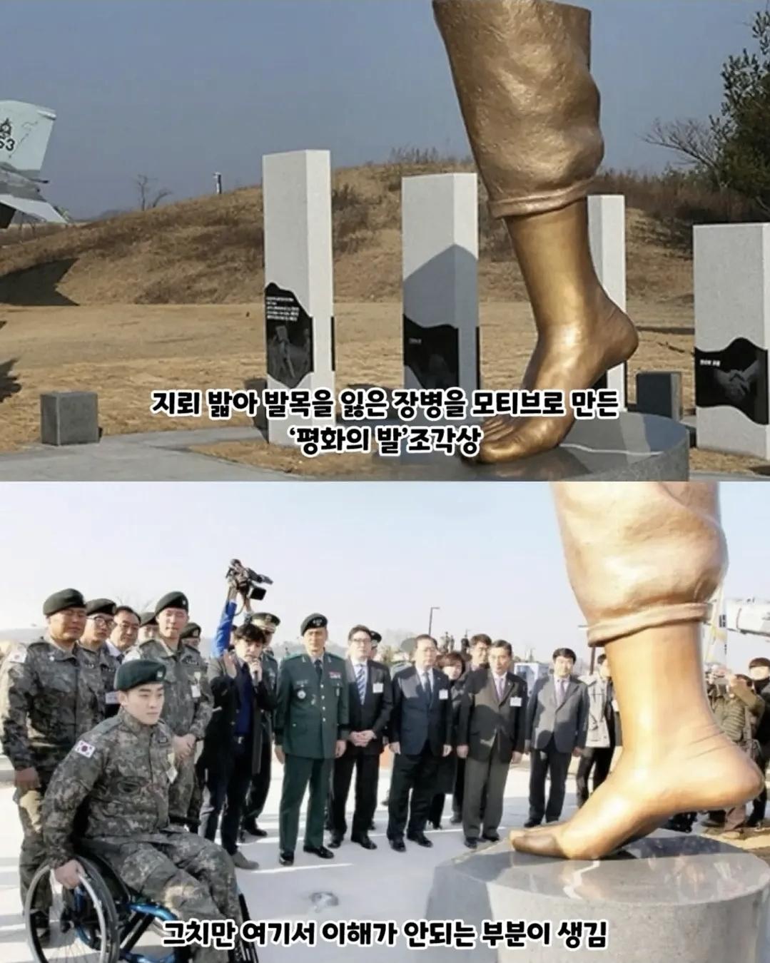 2억짜리  발목 동상 (2)