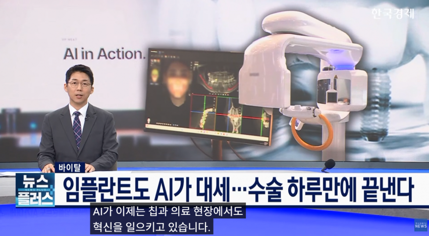 임플란트도 AI가 대세…수술 하루 만에 끝낸다