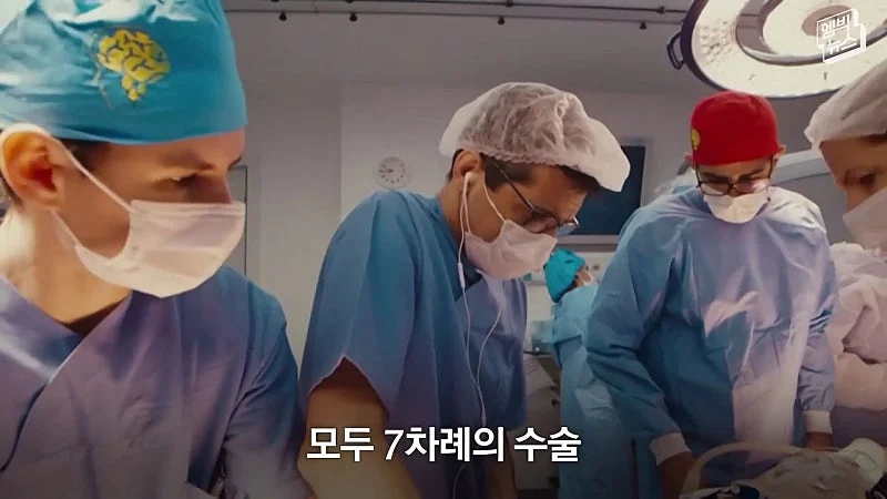 33시간 수술 끝에 얼굴 본 쌍둥이 (34)
