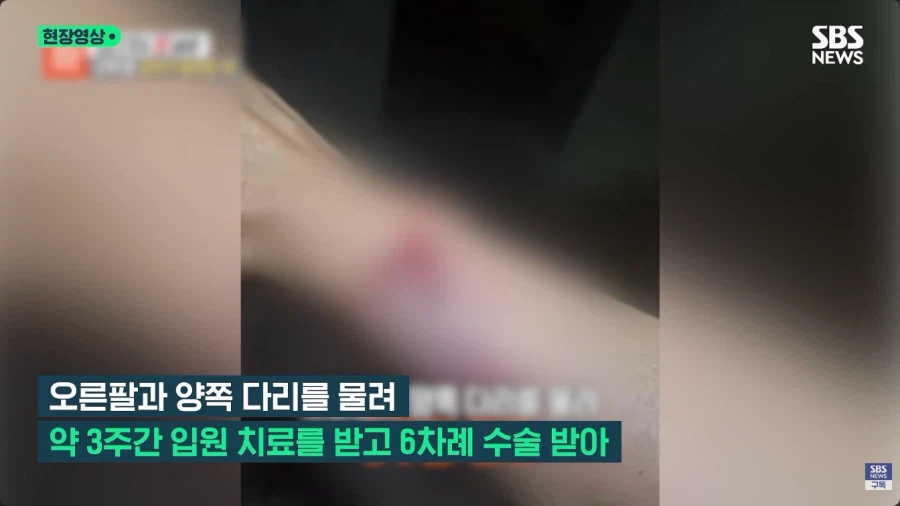 개물림 사고를 낸 견주의 황당한 주장 (3)
