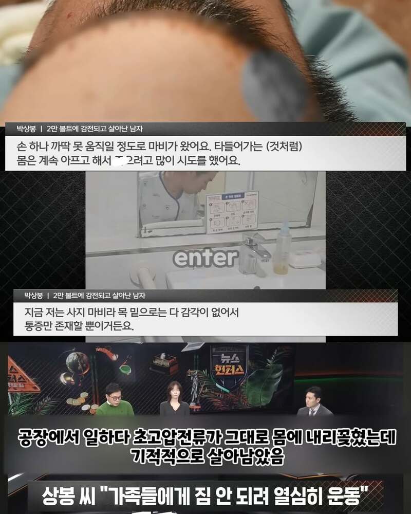 2만볼트 감전되었다 깨어난남성, 깨어난후가 더 지옥