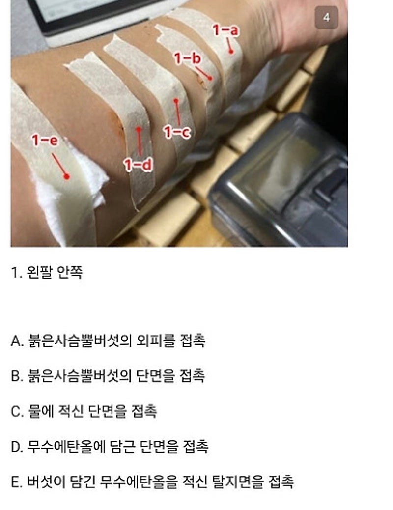 붉은사슴뿔버섯을 본인 몸에 실험한 일본인 (4)