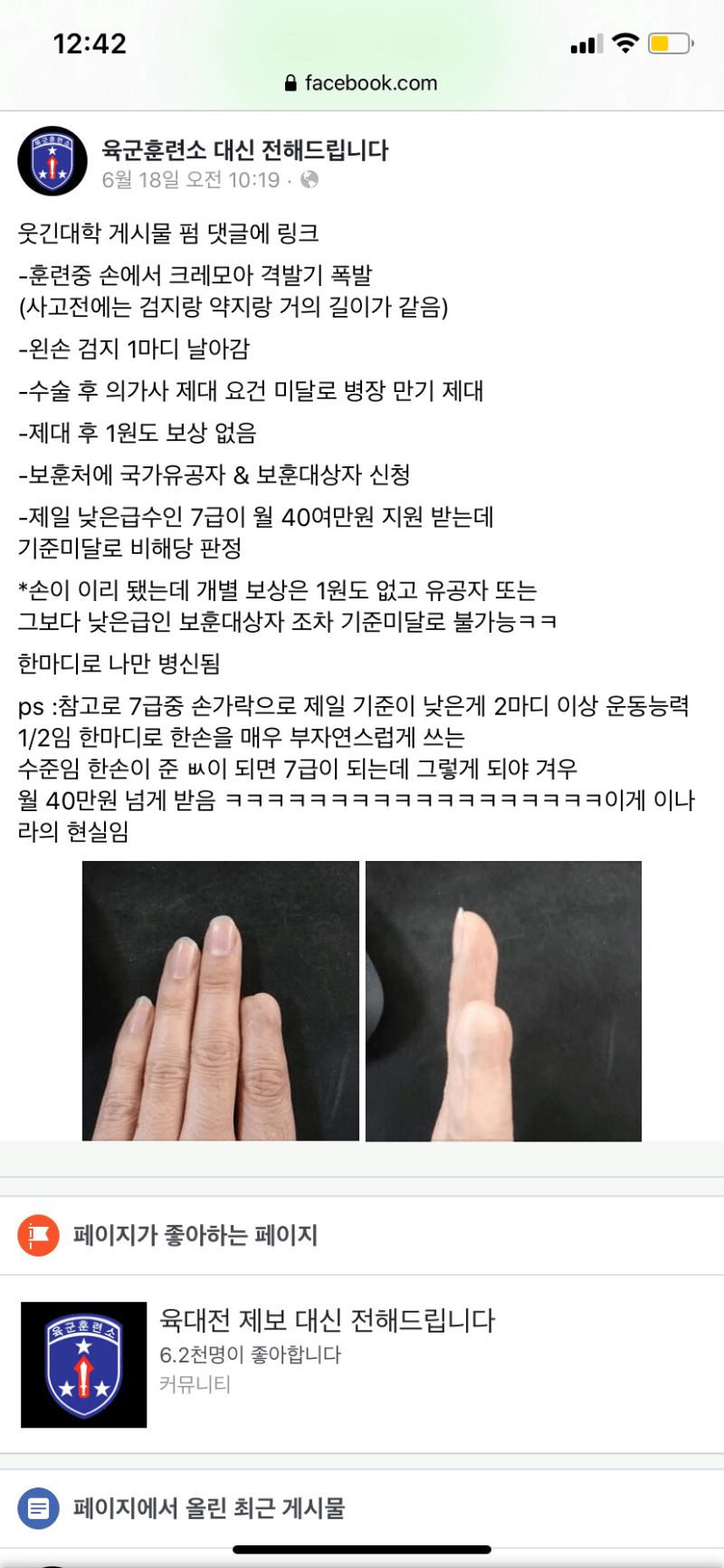 육대전))크레모아 격발 중 폭발사고