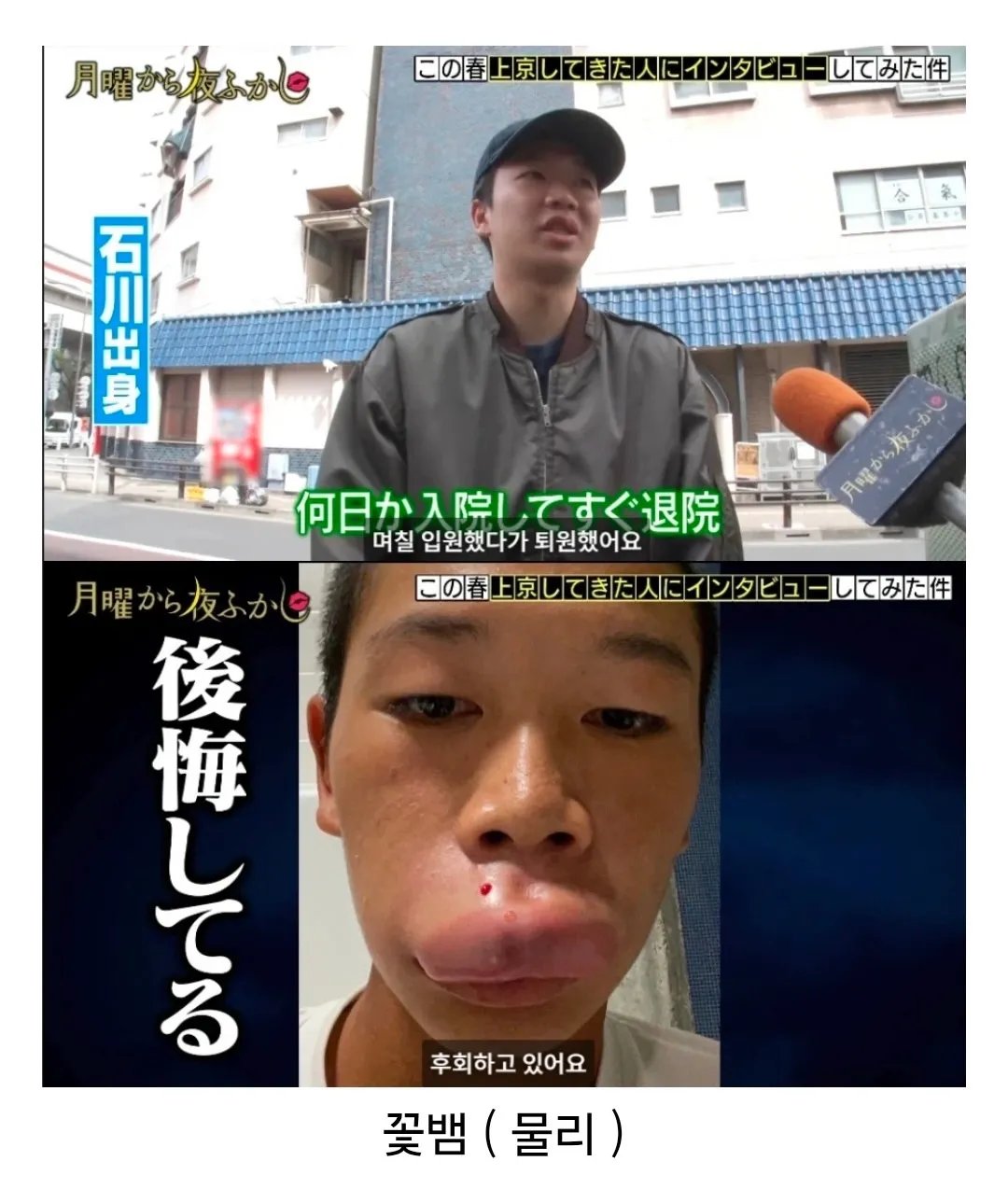 도쿄에 오자마자 꽃뱀에게 물린 시골 청년 (4)