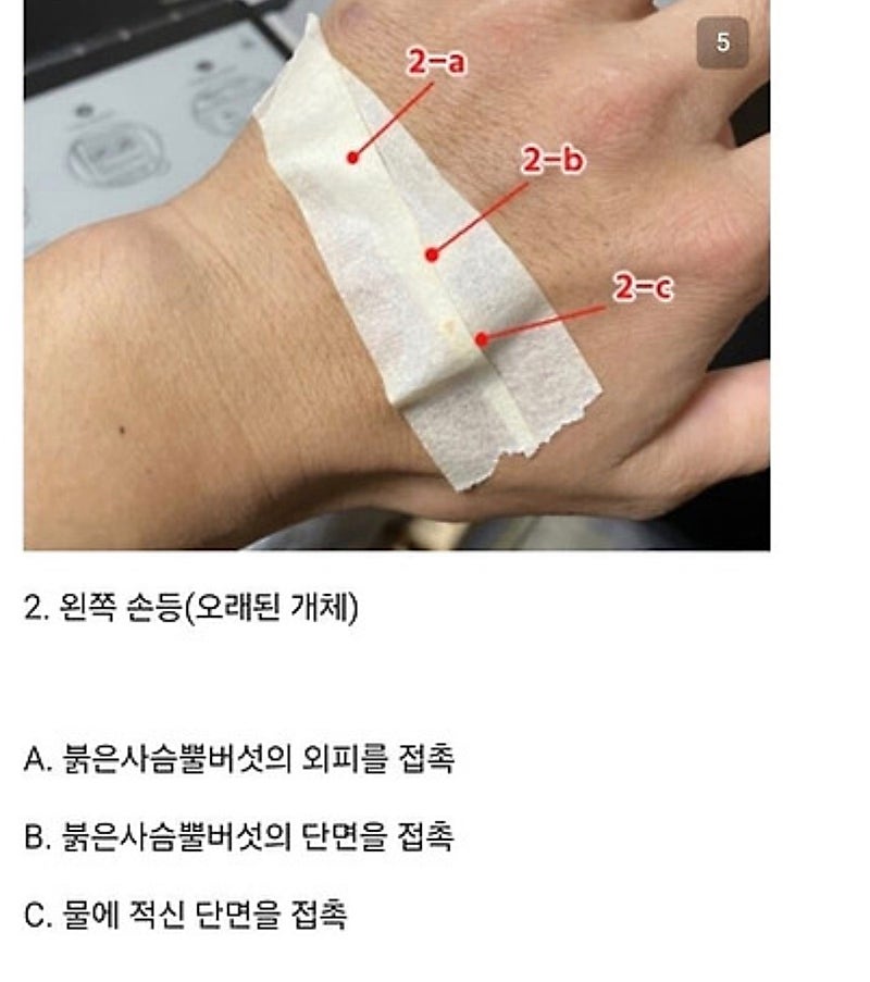붉은사슴뿔버섯을 본인 몸에 실험한 일본인 (5)