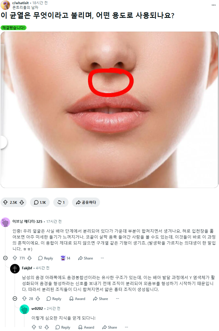 질문: 인중은 왜 존재하고 용도가 무엇인가요?