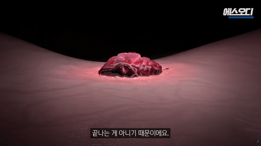 비아그라는 위대했다..역대급 암치료법 등장 (7)