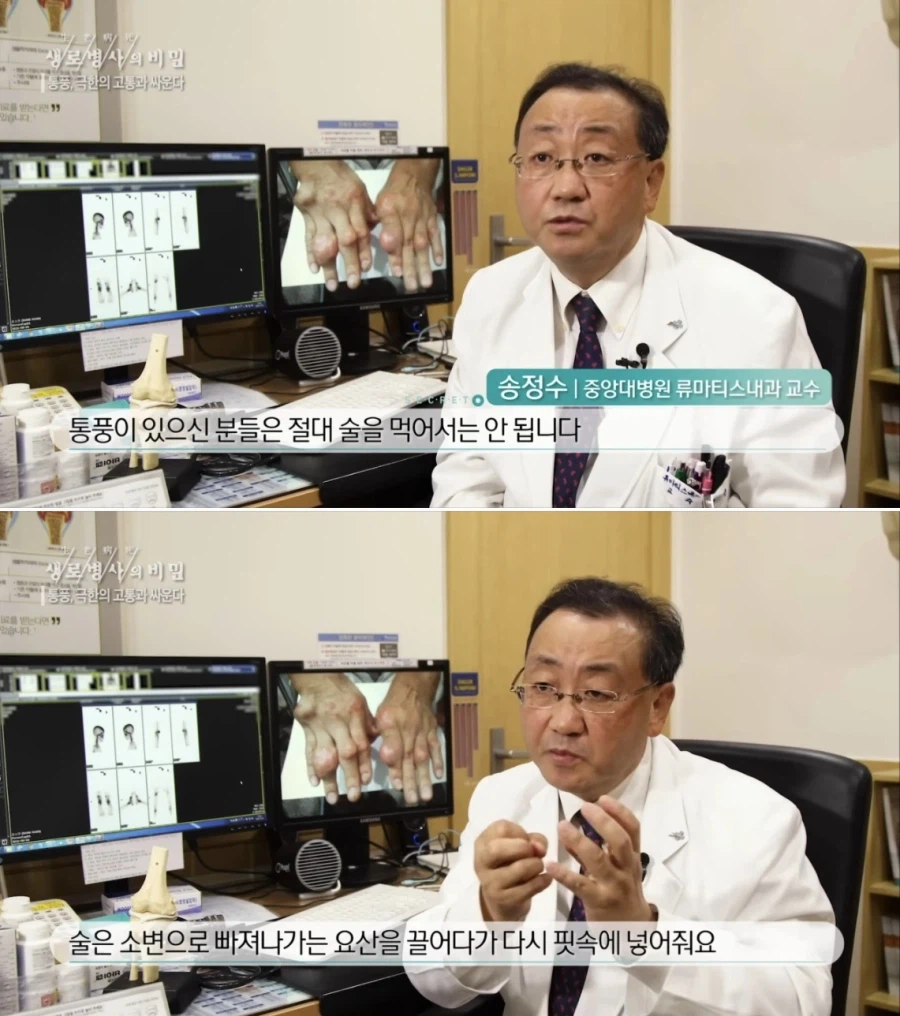소주엔 퓨린이 없다고? ㅋㅋㅋㅋ통풍 안걸리네 개꿀 (3)
