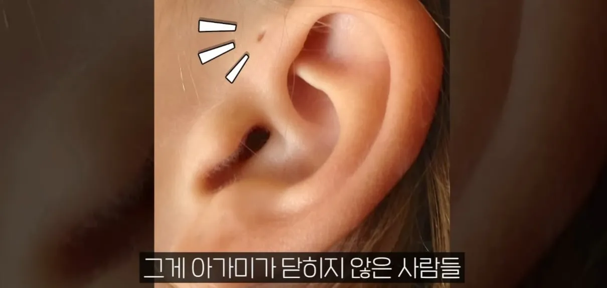 사람의 귀가 아가미에서 진화했다?