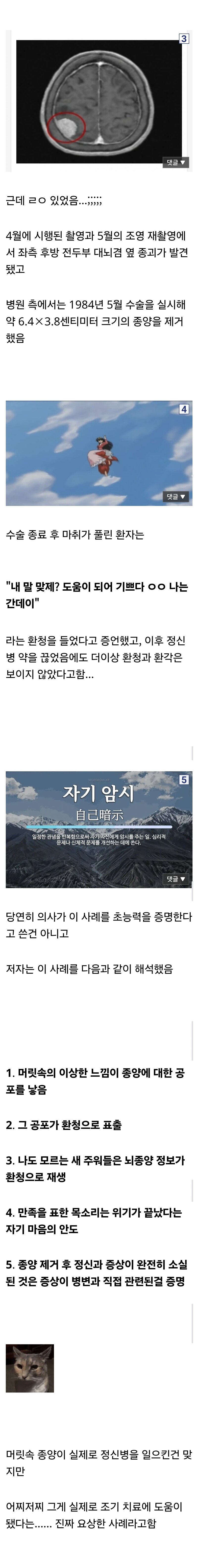 뇌종양이 나한테 말검 (2)