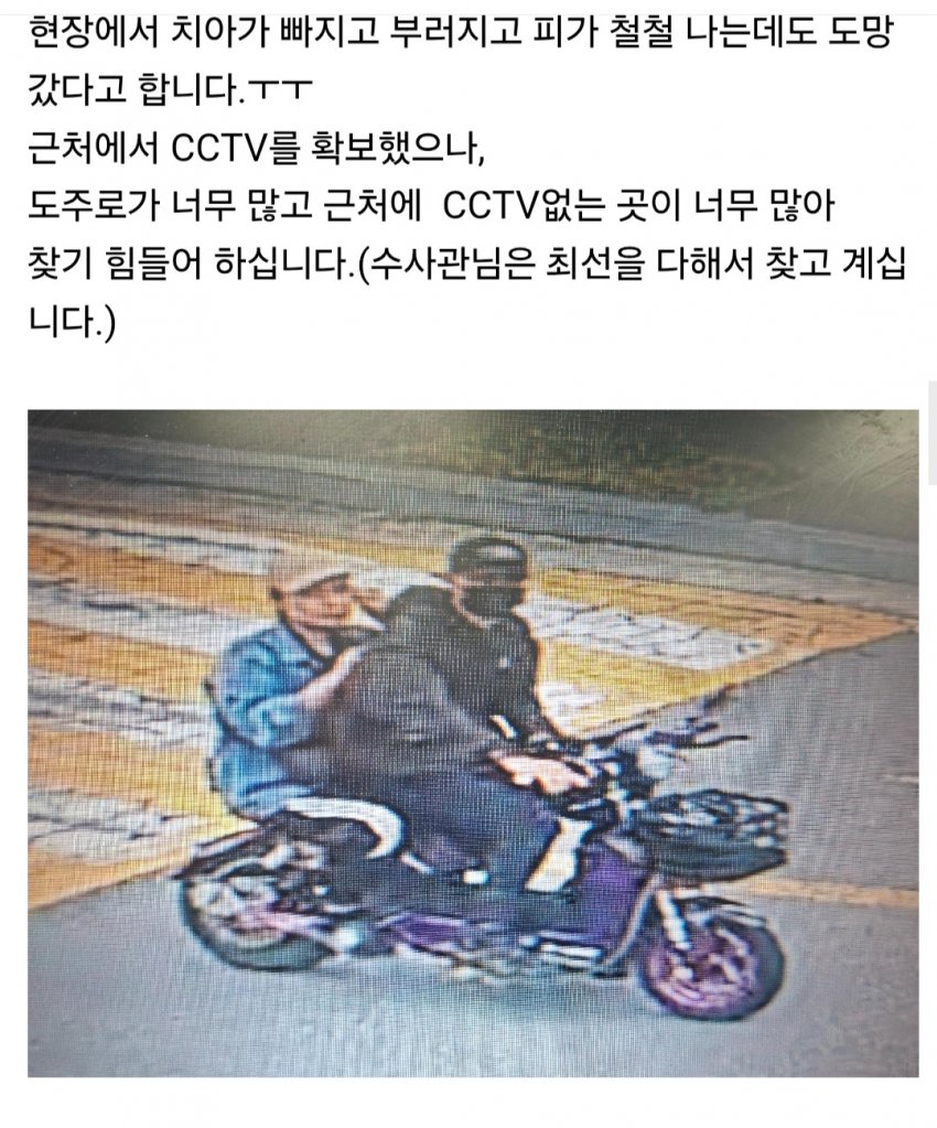 혐주의) 으악으악 외국인이 여자아이 치고 뺑소니 쳐 치아 파손 (4)