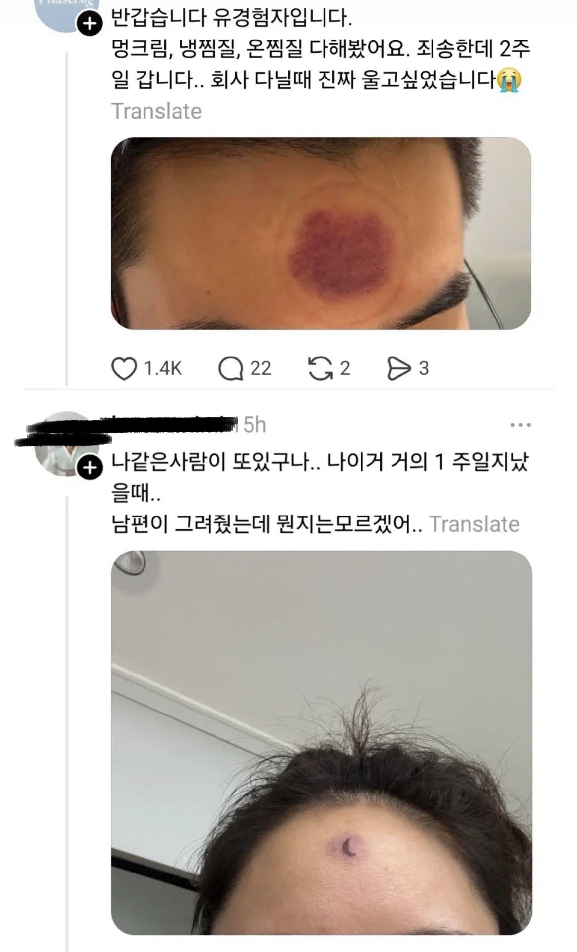 은근 피해자가 많다는 제품 (3)
