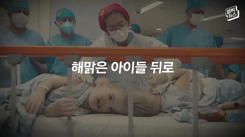 33시간 수술 끝에 얼굴 본 쌍둥이 (14)